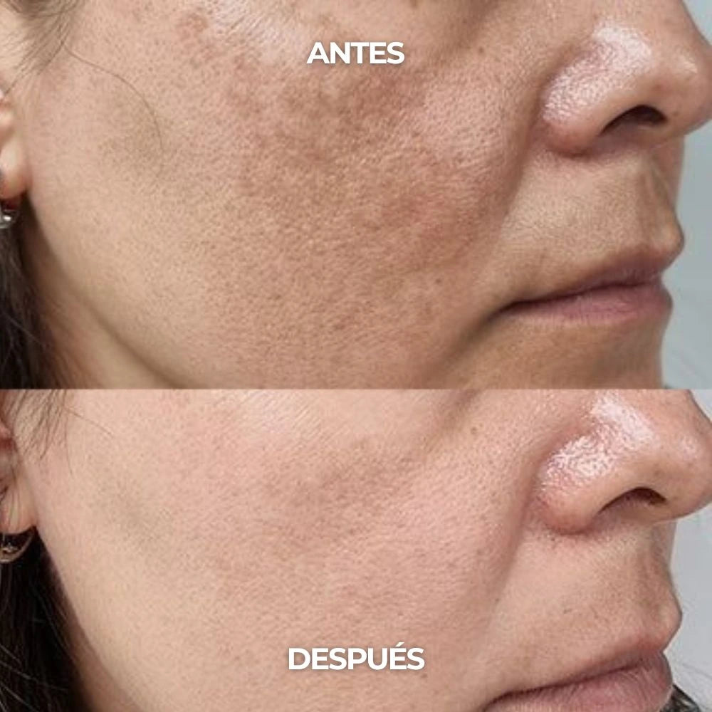 Crema Facial Antimanchas Con Ácido Tranexámico