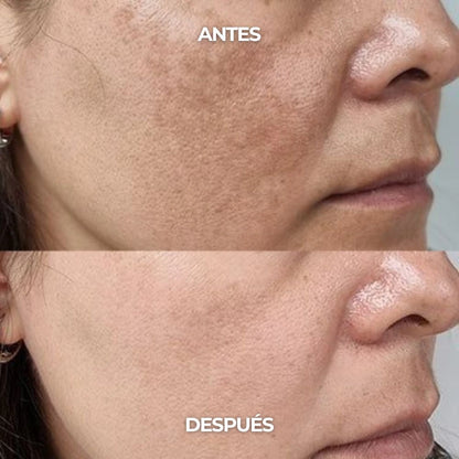 Crema Facial Antimanchas Con Ácido Tranexámico